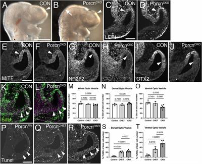 Porcn is essential for growth and invagination of the mammalian optic cup